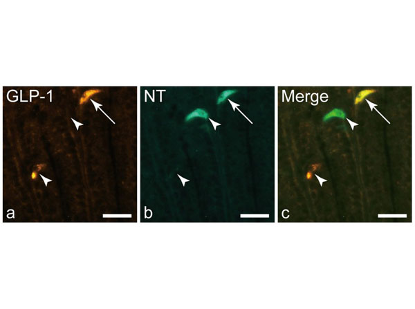 Immunofluorescence results with Donkey Anti-Rabbit IgG Rhodamine