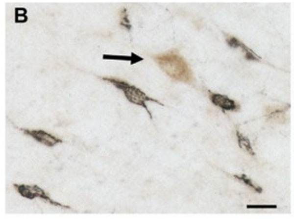 Immunohistochemistry using Donkey anti-rabbit IgG biotin conjugated