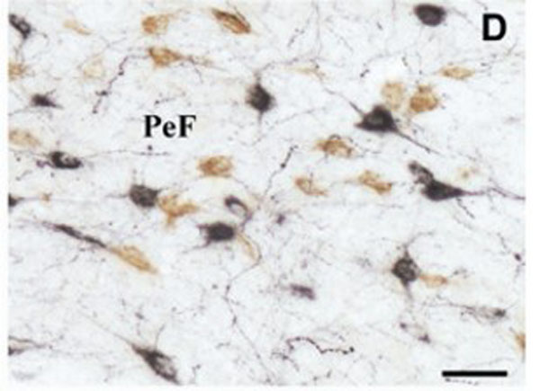 Immunohistochemistry using Donkey anti-rabbit IgG biotin conjugated