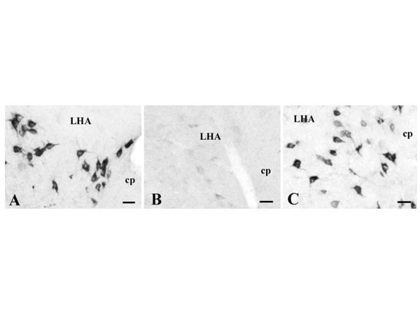 Immunohistochemistry using Donkey anti-rabbit IgG biotin conjugated