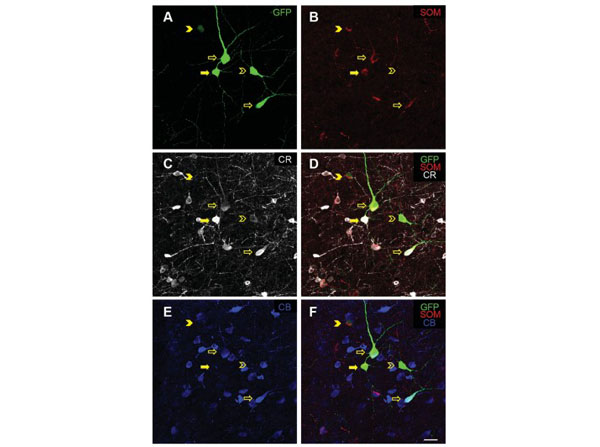 Immunofluorescence using Goat Anti-Rat IgG DyLight™649