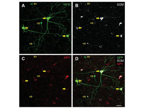 Immunofluorescence using Goat Anti-Rat IgG DyLight™649