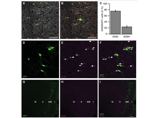 Immunofluorescence using Goat Anti-Rat IgG DyLight™649