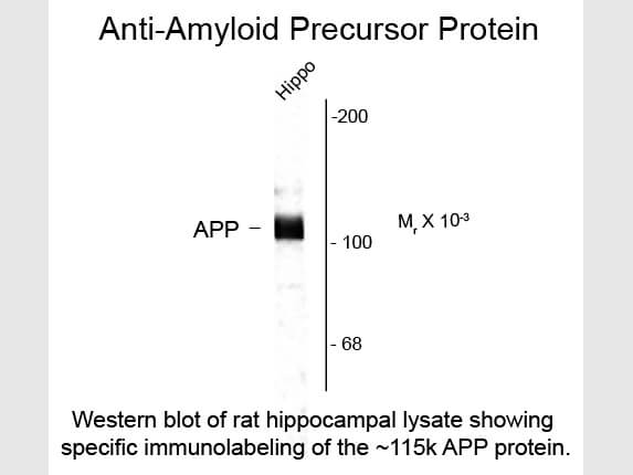 Western Blot of Anti-Beta Amyloid (Rabbit) Antibody - 612-401-253