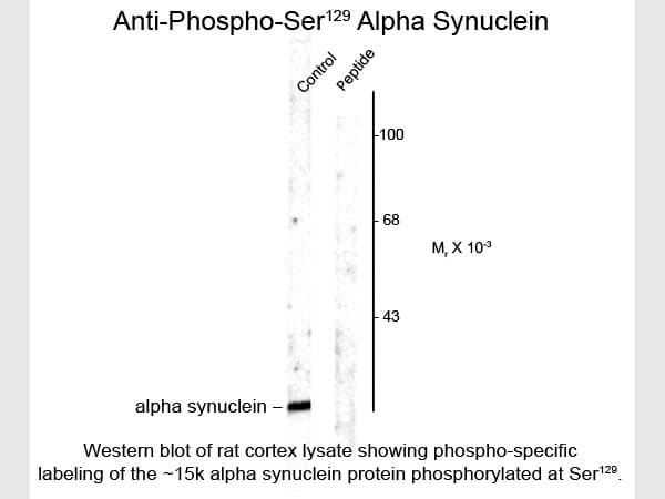 Western blot of Alpha synuclein ser129 Antibody
