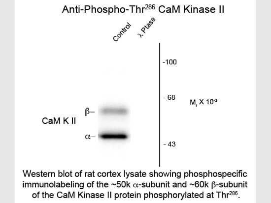 CaM Kinase II phospho T286 Antibody