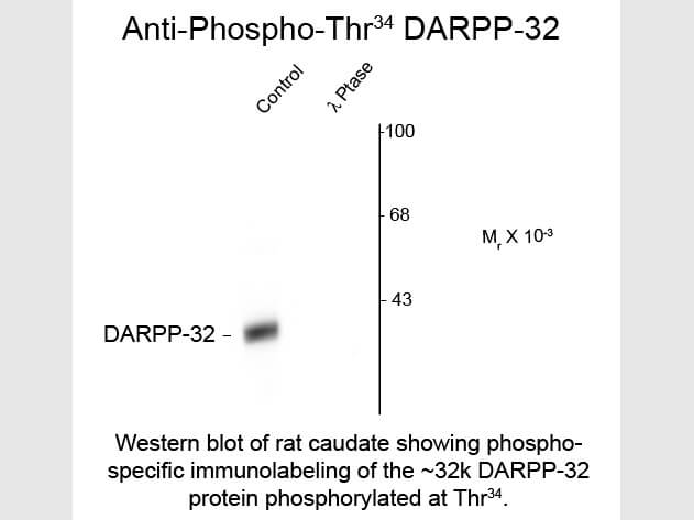 Western blot of DARPP-32 Thr34 Antibody