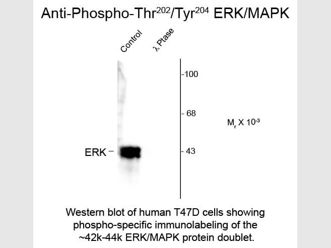 Western blot of ERK-MAPK Thr202-Tyr204 Antibody