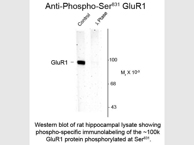Western blot of GluR1-Subunit Ser831 Antibody