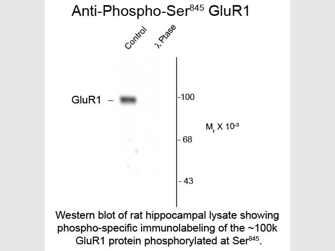 Western blot of GluR1-Subunit Ser845 Antibody