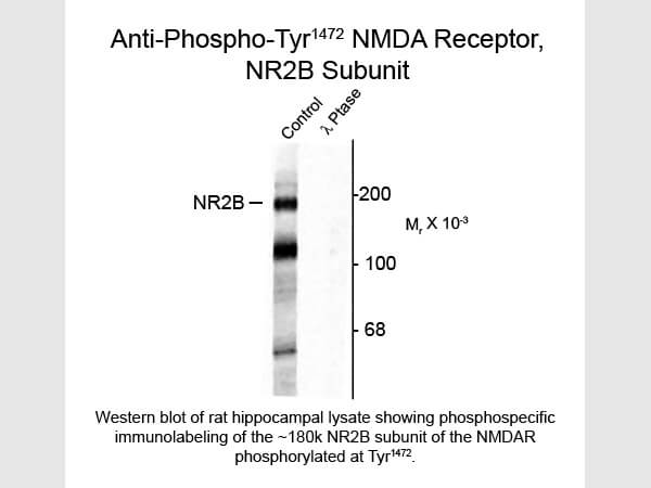 Western blot of NMDA NR2B Subunit Tyr1472 Antibody