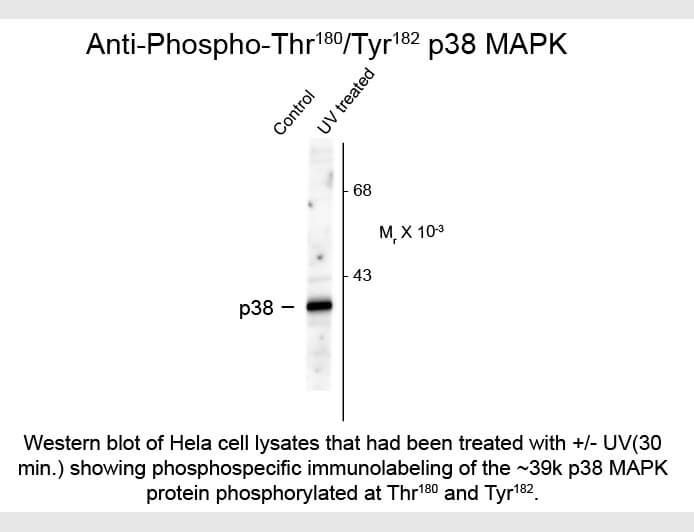 Western blot of p38 MAPK Thr180-Tyr182 Antibody
