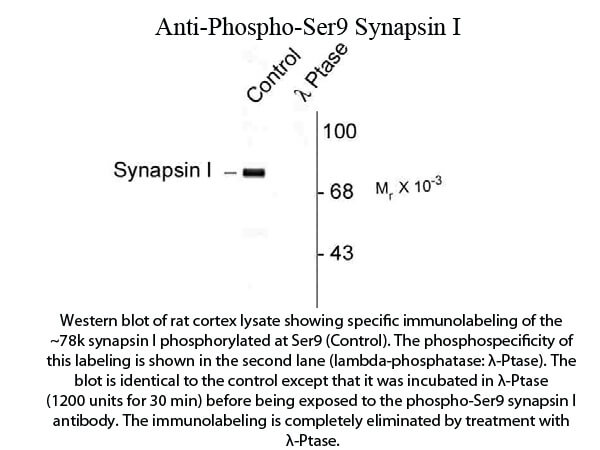 Western blot of Synapsin I Ser9 Antibody