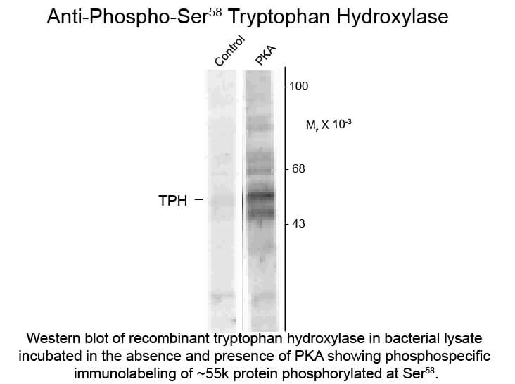 Western blot of Tryptophan Hydroxylase Ser58 Antibody