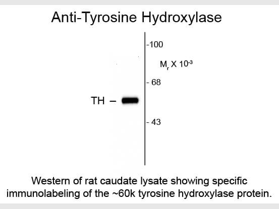 Western blot of Tyrosine Hydroxylase Antibody