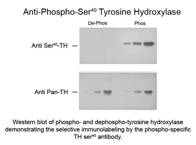 Western blot of Tyrosine Hydroxylase Ser40 Antibody