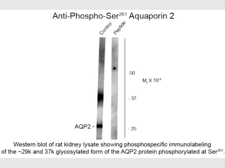 Western Blot of Anti-Aquaporin 2 pS261 (Rabbit) Antibody - 612-401-D08