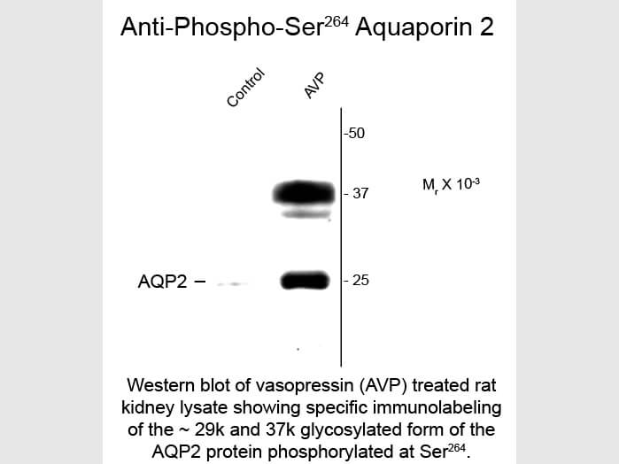 Western Blot of Anti-Aquaporin 2 pS264 (Rabbit) Antibody - 612-401-D09