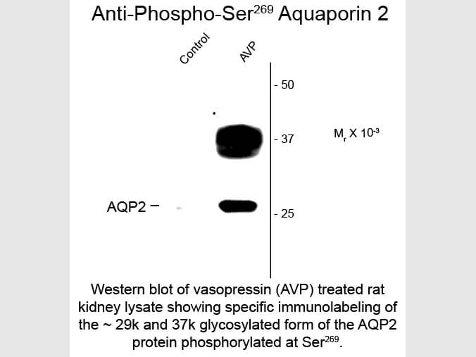 Western Blot of Anti-Aquaporin 2 pS269 (Rabbit) Antibody - 612-401-D10