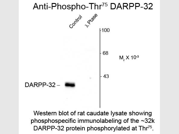 Western Blot of Anti-DARPP-32 pT75 (Rabbit) Antibody - 612-401-D25