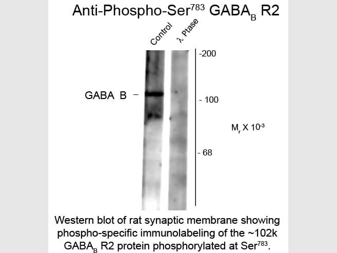 Western Blot of Anti-GABA(B) Receptor 2 pS783 (Rabbit) Antibody - 612-401-D53