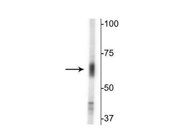 Western blot of Anti-GAT2 antibody