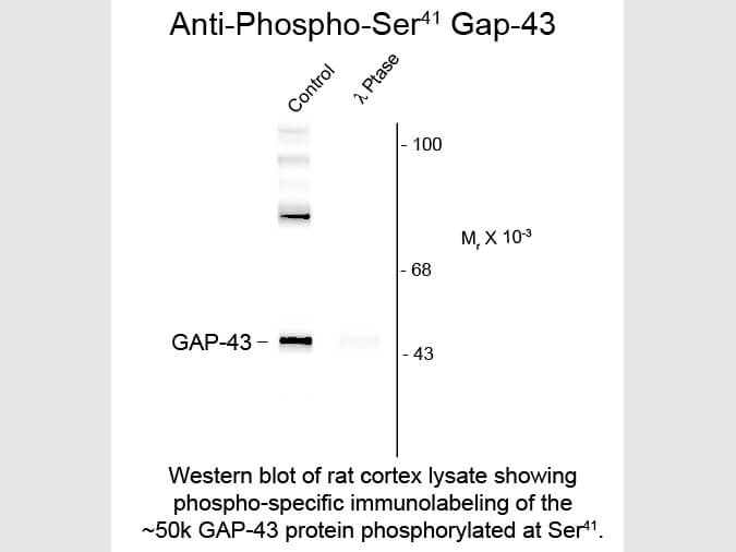 Western Blot of Anti-Neuromodulin (GAP43) pS41 (Rabbit) Antibody - 612-401-D59