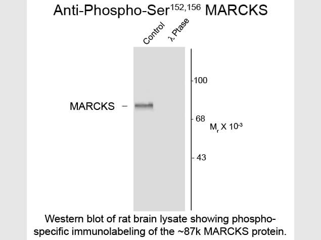Western Blot of Anti-MARCKS pS152/pS156 (Rabbit) Antibody - 612-401-D70