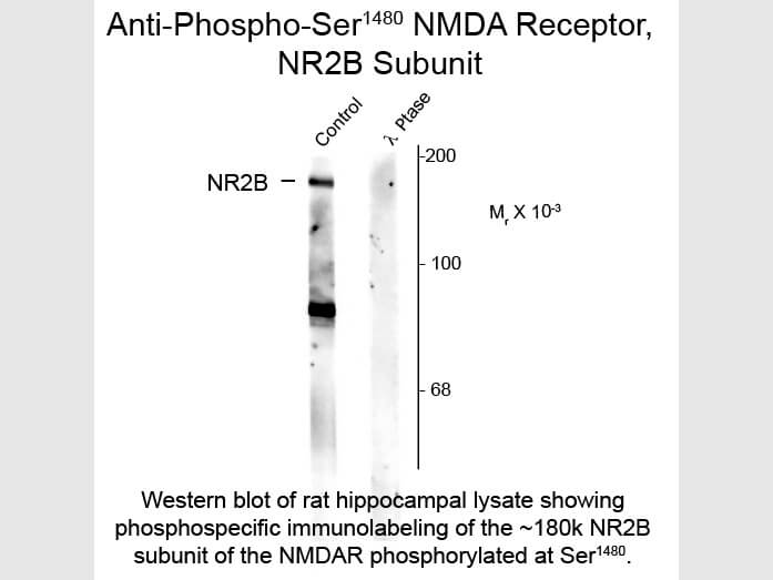 Western blot of Anti-NMDA 2B pS1480 (Rabbit) Antibody - 612-401-D93