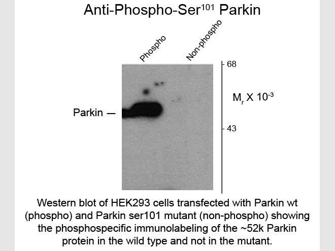 Western blot of Anti-Parkin pS101 (Rabbit) Antibody - 609-401-E06