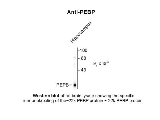 Western blot of Anti-PEBP (phosphatidylethanolamine binding protein) (Rabbit) Antibody - 112-401-E08