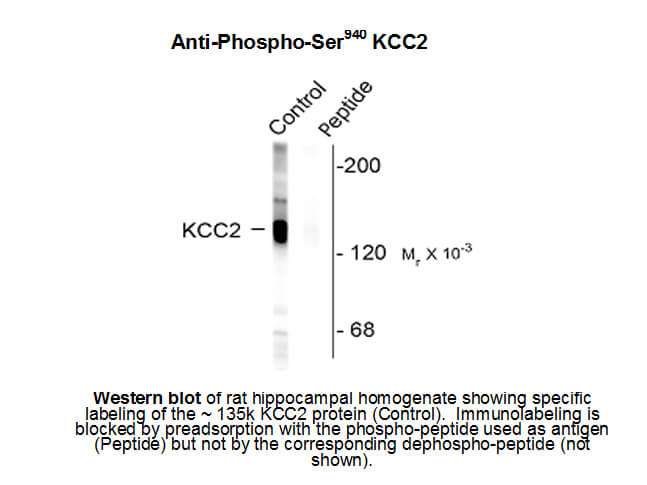 Western blot of Anti-Potassium Chloride Cotransporter (KCC2) pS940 (Rabbit) Antibody - 612-401-E15