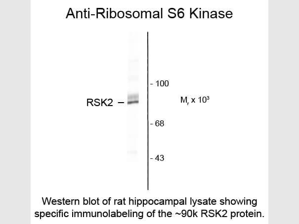 Western blot of Anti-p90 RSK2 (Rabbit) Antibody - 600-401-E30