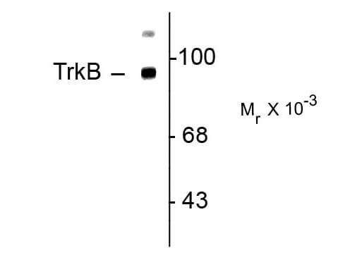 Western Blot of Rabbit Anti-TrkB Antibody