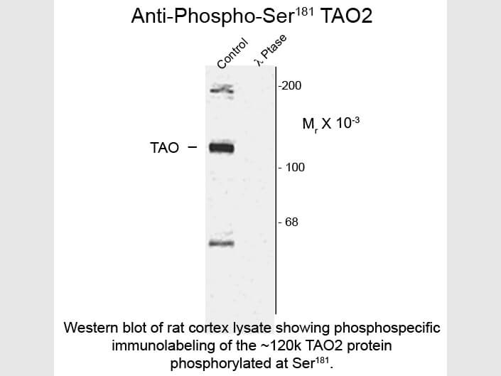 Western blot of Anti-TAO2 pS181 (Rabbit) Antibody - 600-401-E41