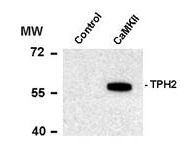 Tryptophan Hydroxylase phospho S19 Antibody - Western Blot