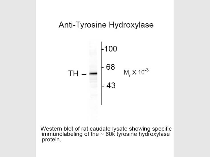 Western blot of Tyrosine Hydroxylase Antibody