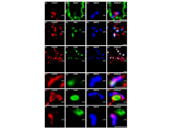 Immunofluorescence using Rabbit Fab Anti-Mouse IgG