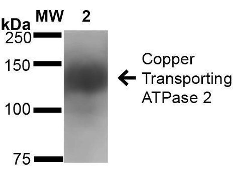 Western Blot of Anti-ATPase