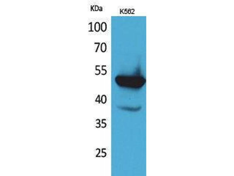 Western Blot of Anti-Vitamin K-dependent protein C Protein