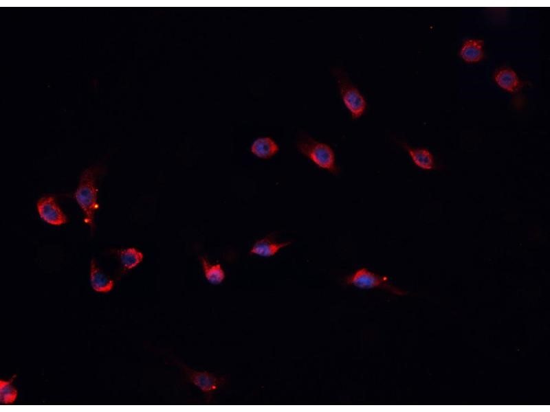 Immunofluorescence of Anti-Protein S Antibody