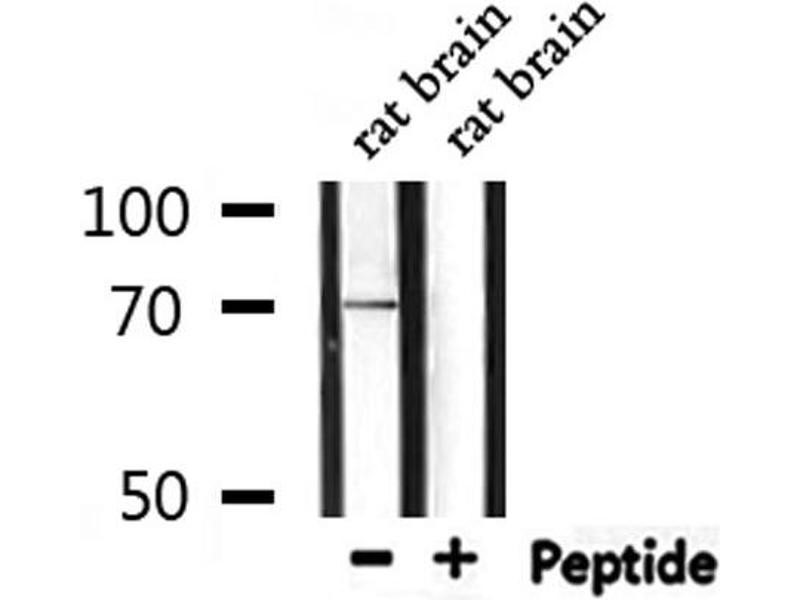 Western Blot of Anti-Protein S Antibody