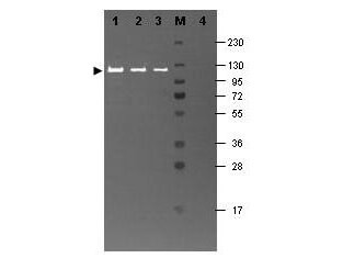 Hamster Complement (Lyophilized) With Diluent