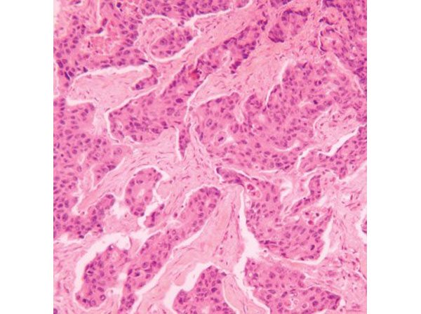 Immunohistochemistry using Hematoxylin
