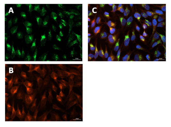 Immunofluorescence using Anti-2′-OMe Clone OME03