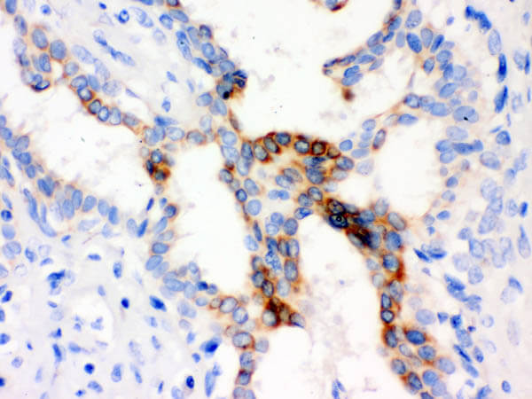 Immunohistochemistry of Mouse Specific 2 step biotin-free HRP IHC Detection Kit