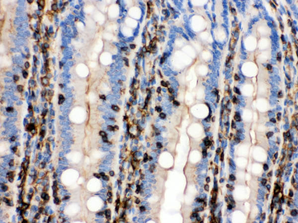 Immunohistochemistry of Mouse Specific 2 step biotin-free HRP IHC Detection Kit