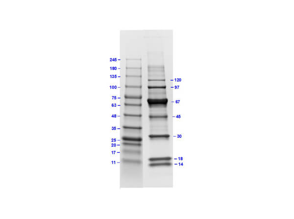 SDS Page of Protein Molecular Weight Marker 14-120kDa
