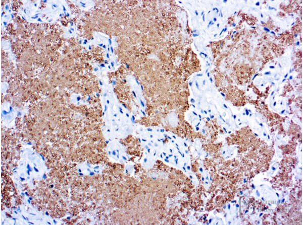 Immunohistochemistry of Mouse Anti-Pneumocystis Carinii Antibody