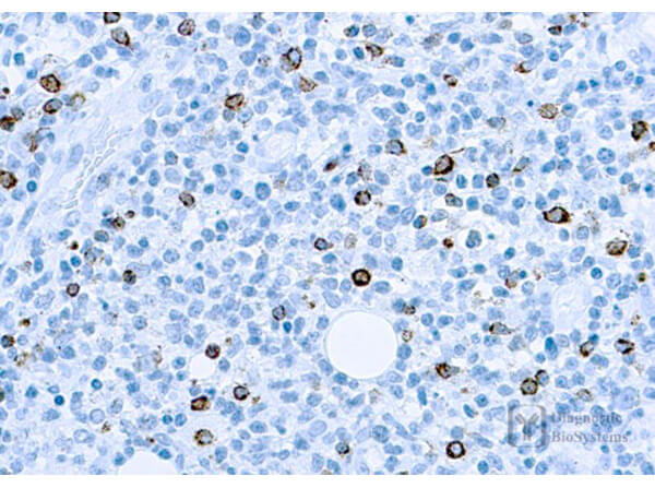 Immunohistochemistry of Mouse Anti-LMP-1 (Epstein-Barr Virus) Antibody